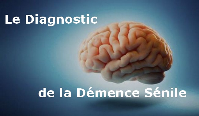 Le Diagnostic de la Démence Sénile