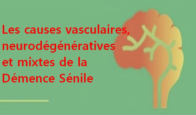 les Causes de la démence sénile