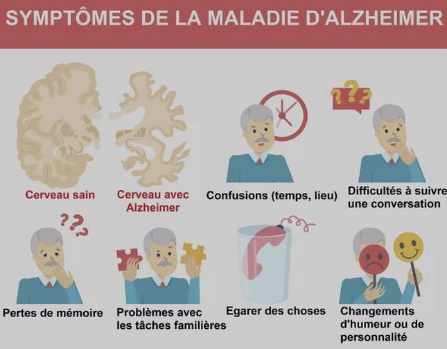 Les symptômes de la maladie d'Alzheimer